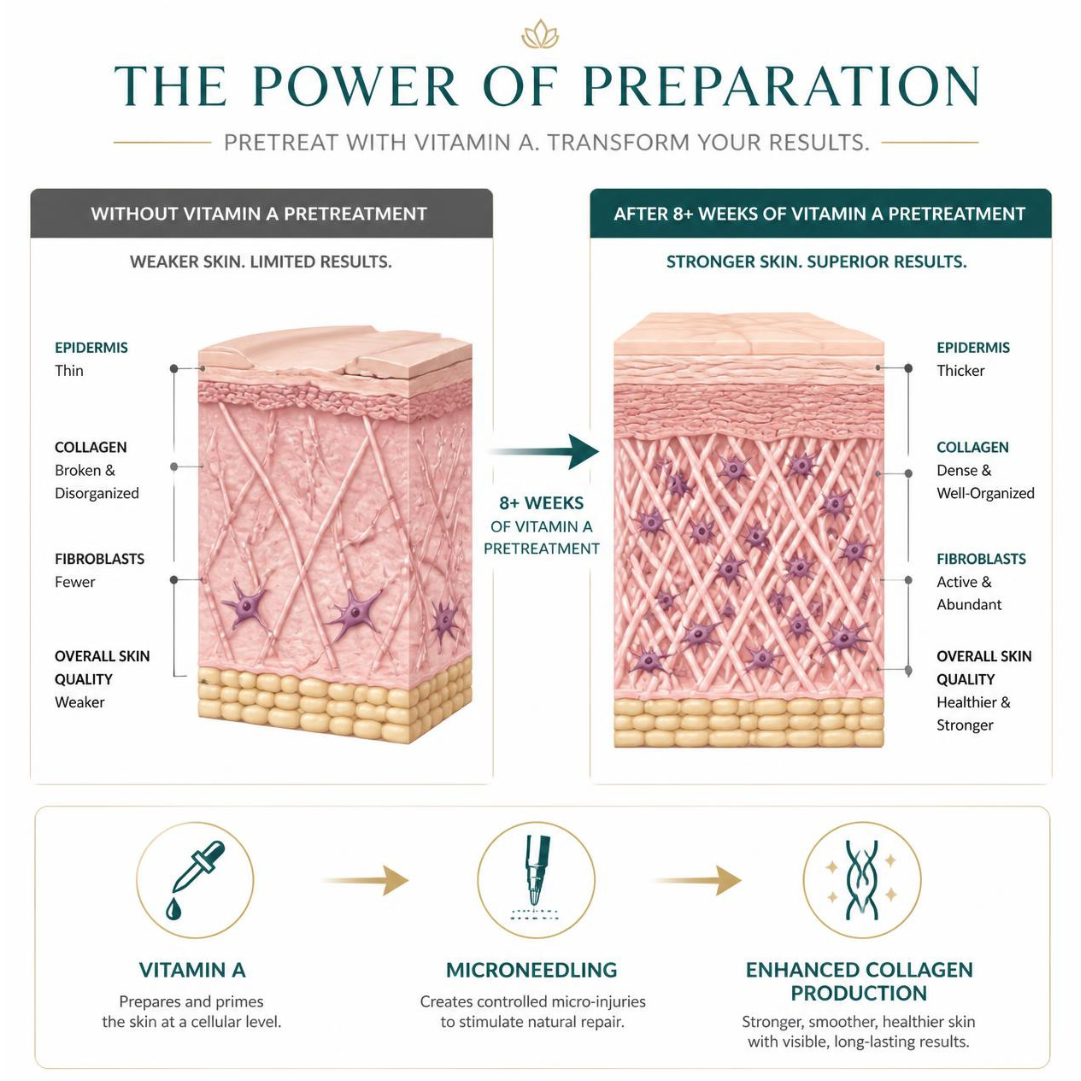 Why Do I Need To Pre-Treat My Skin With 'Vitamin A' Prior To Microneedling?