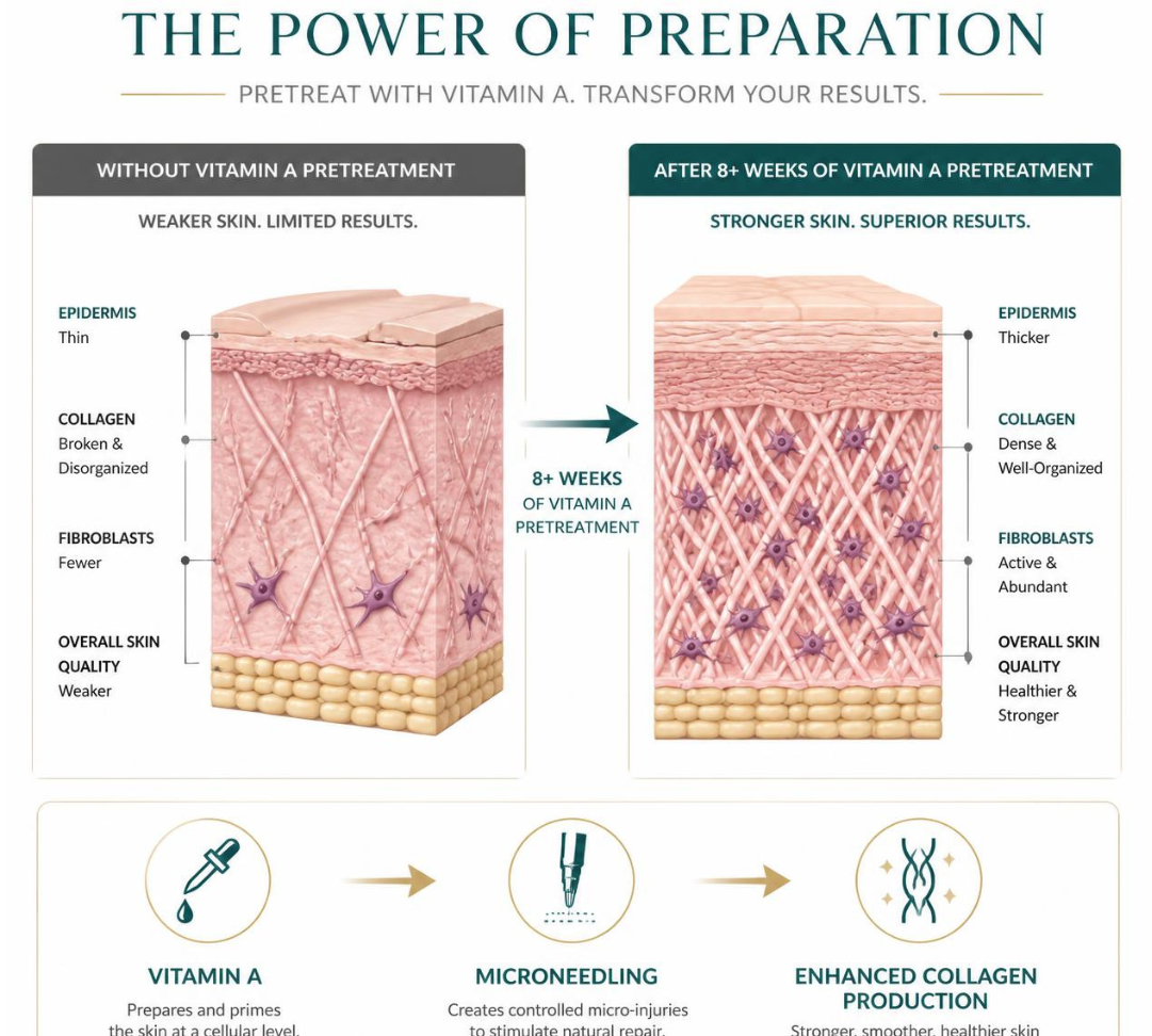 Why Do I Need To Pre-Treat My Skin With 'Vitamin A' Prior To Microneedling?