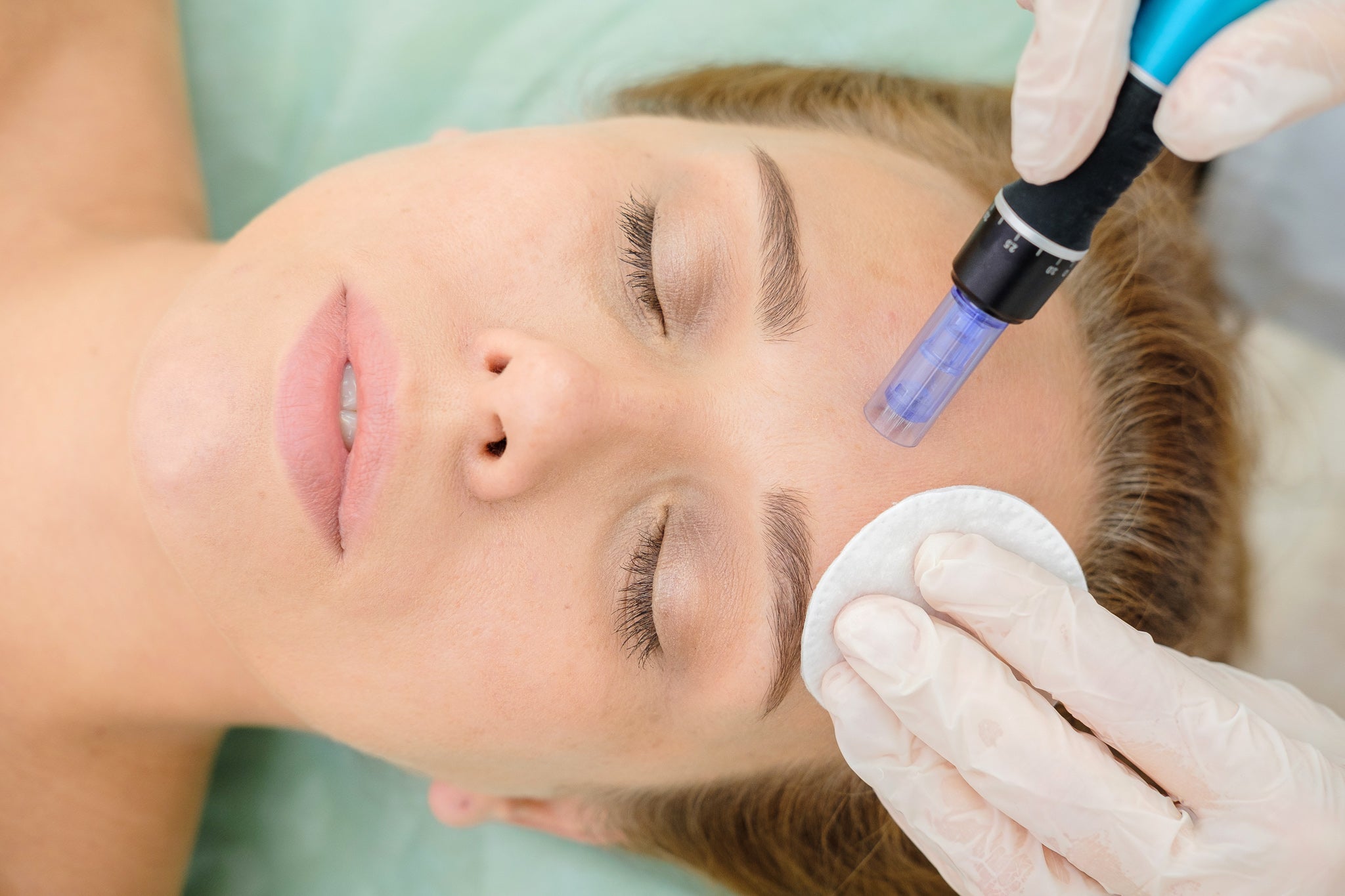 Woman undergoing a dermapen treatment