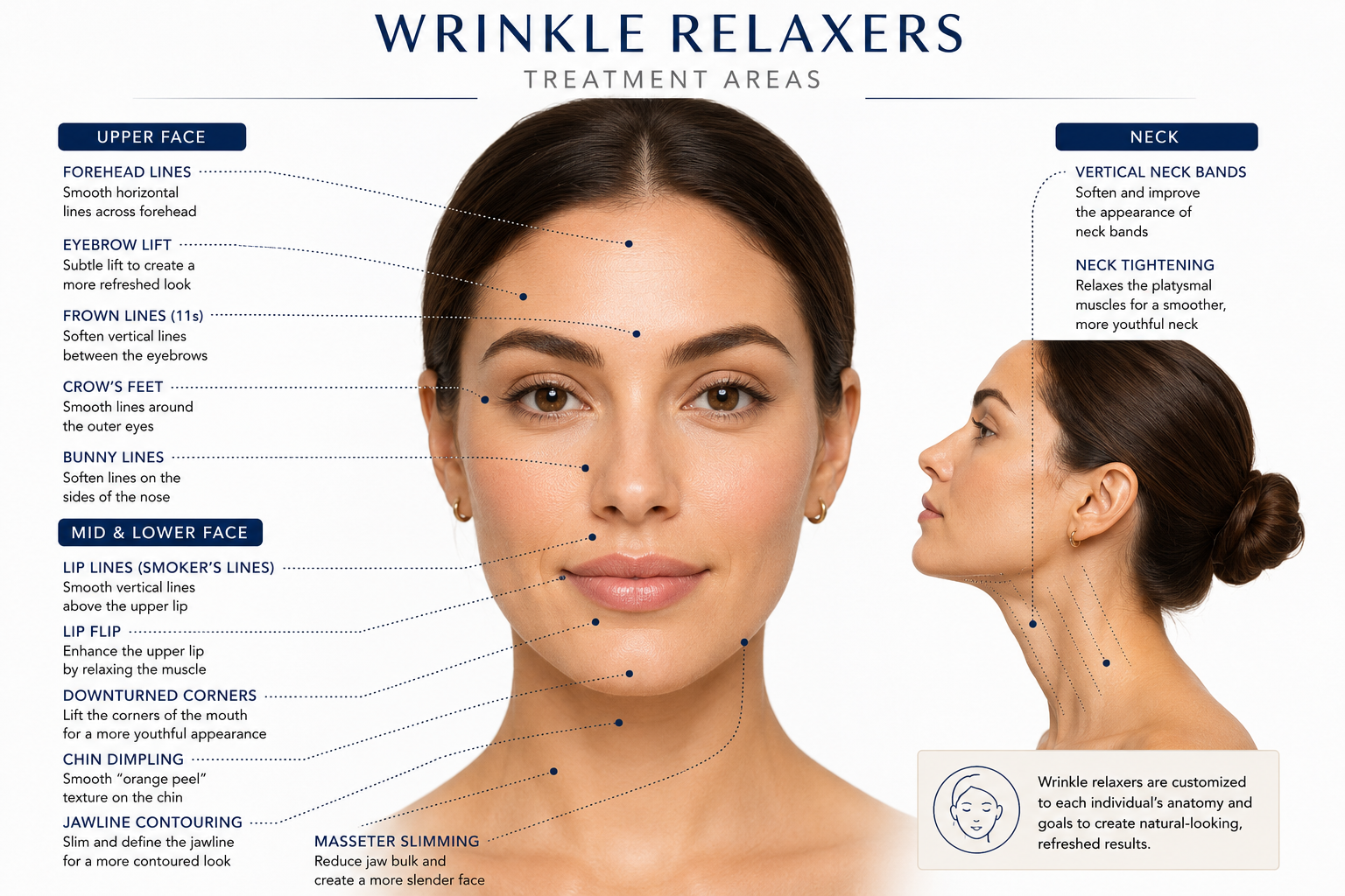 Diagram of wrinkle relaxers treatment areas on a woman's face and neck.