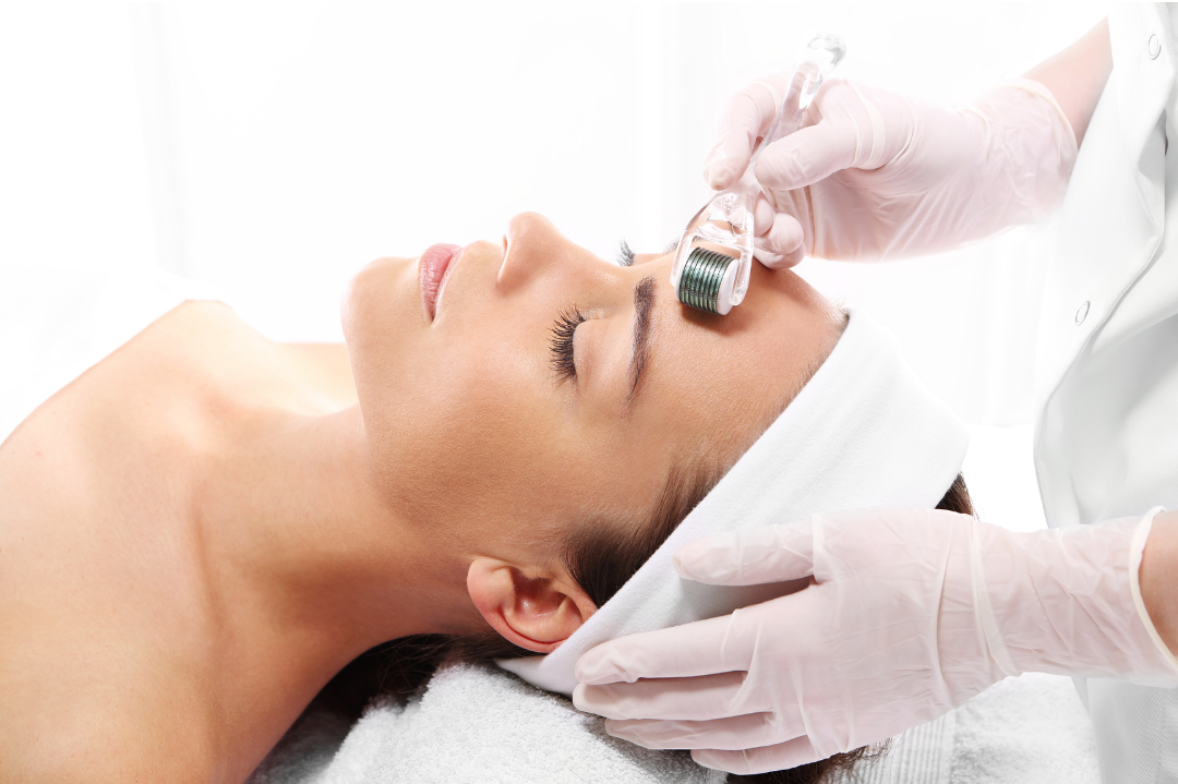 woman getting microneeding with roller