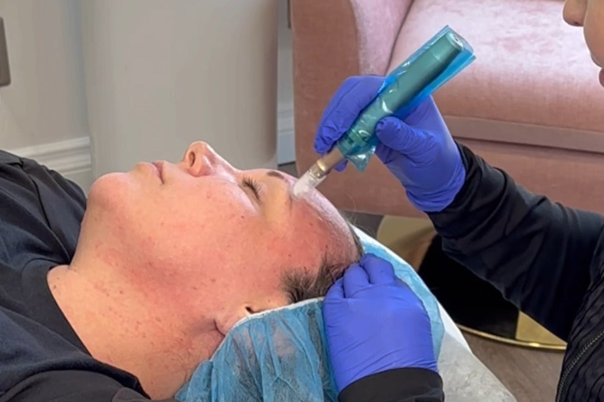 Person receiving a facial treatment with a blue gloved hand holding a tool.