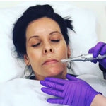 A close-up of a woman lying down with her eyes closed while a silver facial treatment device is being applied to her face by a person wearing purple gloves.