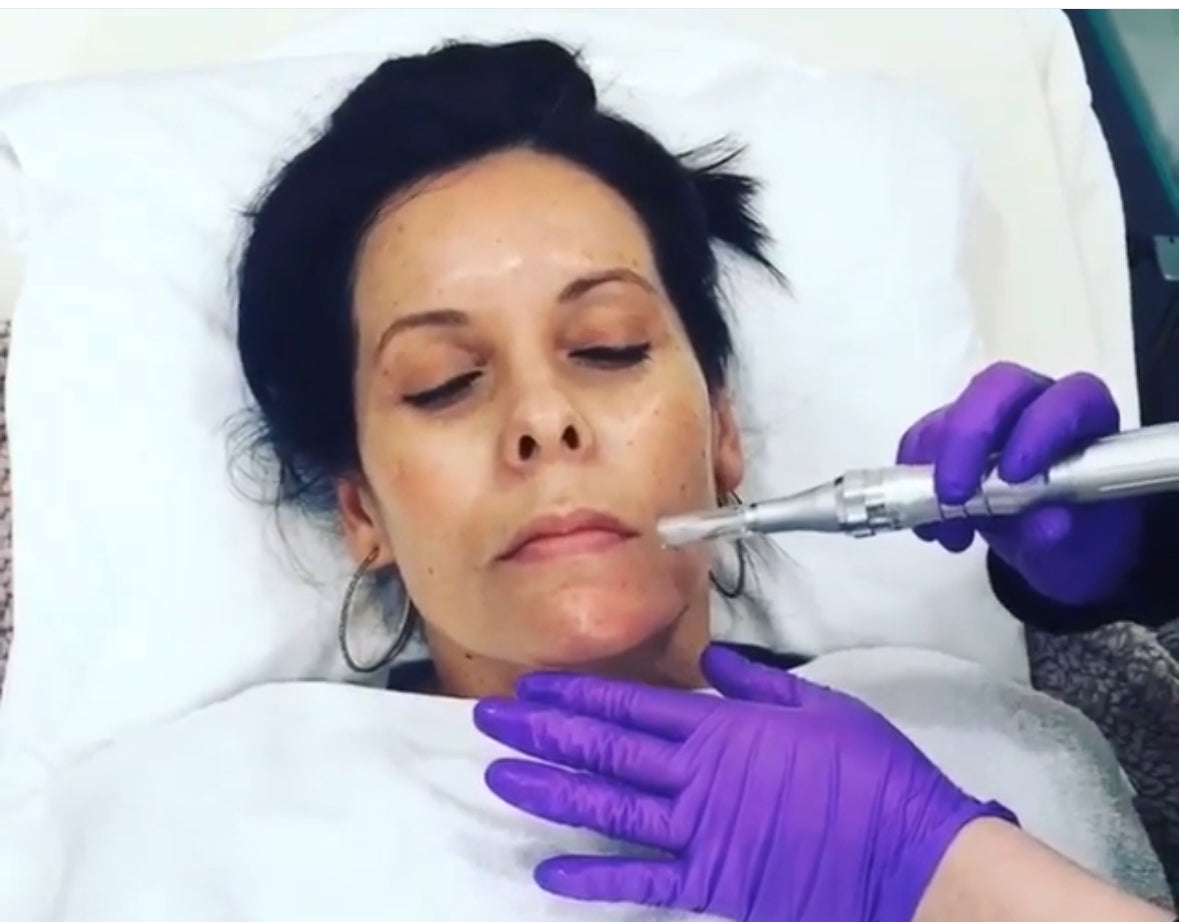 A close-up of a woman lying down with her eyes closed while a silver facial treatment device is being applied to her face by a person wearing purple gloves.